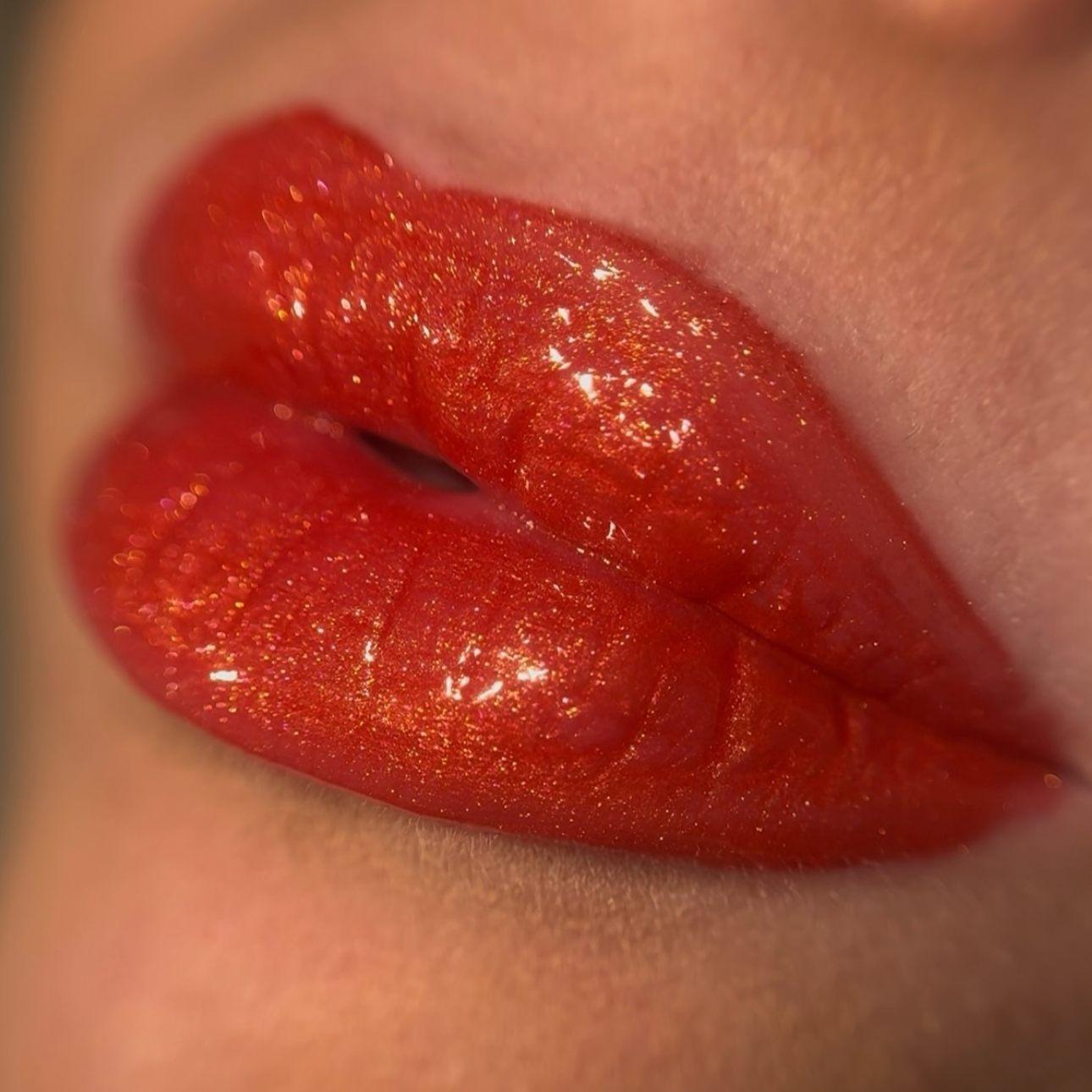 GoldenKiss™ - Miss Lady